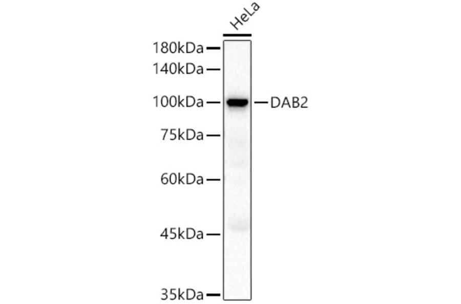 Western Blot - Anti-DAB2 Antibody (A9300) - Antibodies.com