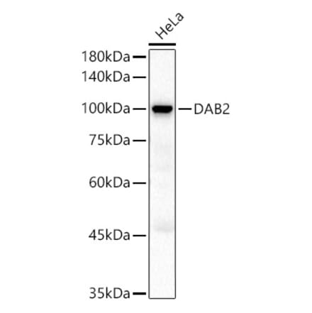 Western Blot - Anti-DAB2 Antibody (A9300) - Antibodies.com