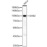 Western Blot - Anti-DAB2 Antibody (A9300) - Antibodies.com