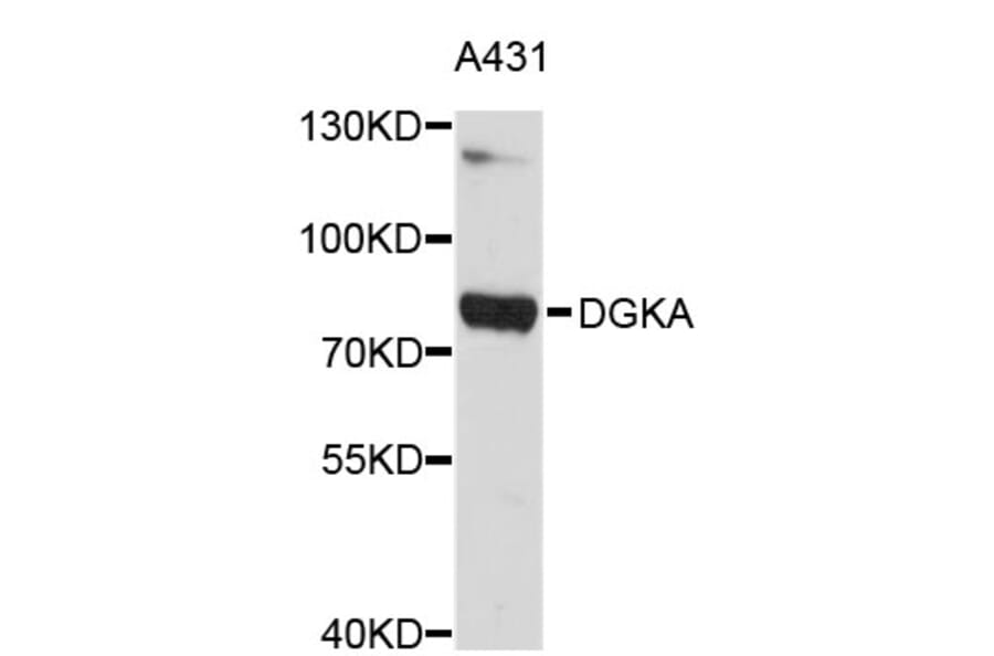 Western Blot - Anti-DGKA Antibody (A3824) - Antibodies.com