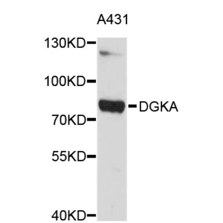 Western Blot - Anti-DGKA Antibody (A3824) - Antibodies.com