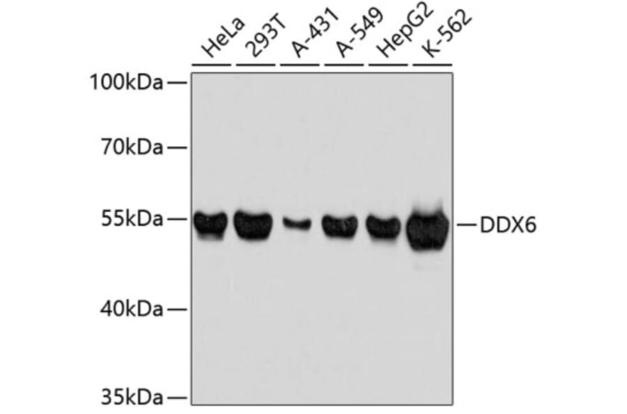 Western Blot - Anti-DDX6 Antibody (A3829) - Antibodies.com