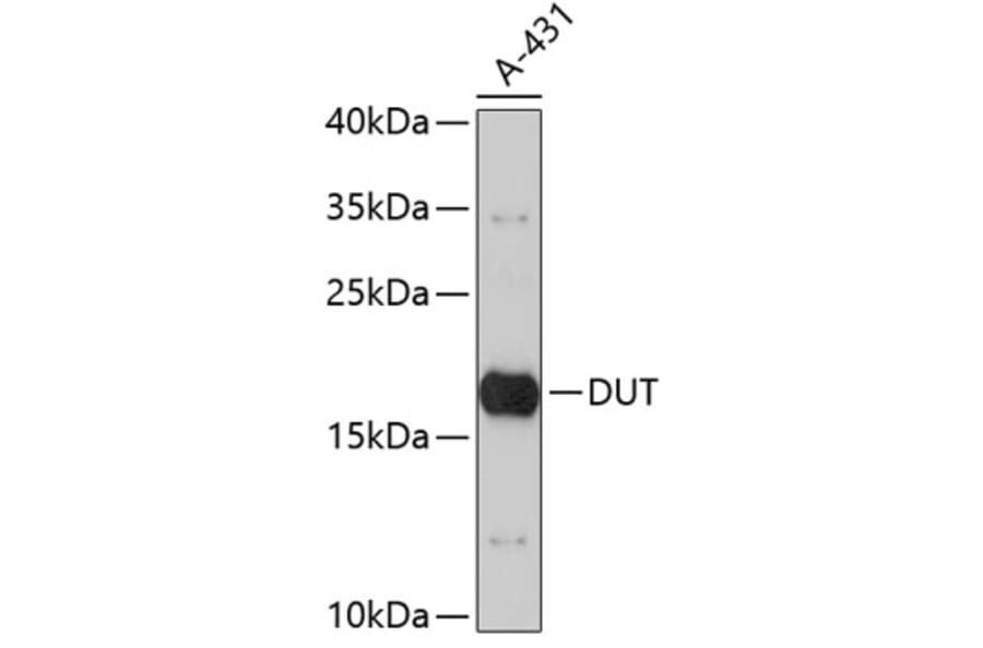 Western Blot - Anti-DUT Antibody (A3840) - Antibodies.com