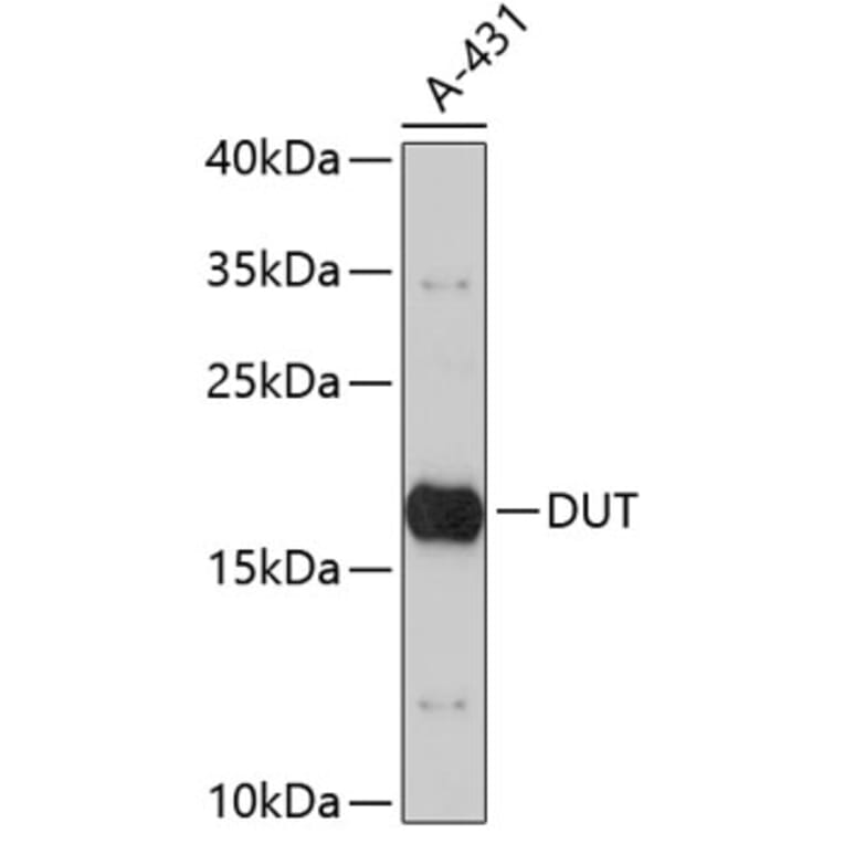 Western Blot - Anti-DUT Antibody (A3840) - Antibodies.com
