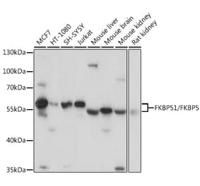 Western Blot - Anti-FKBP51 Antibody (A9309) - Antibodies.com