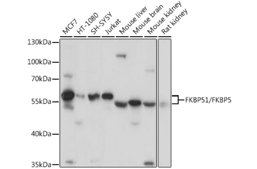 Western Blot - Anti-FKBP51 Antibody (A9309) - Antibodies.com