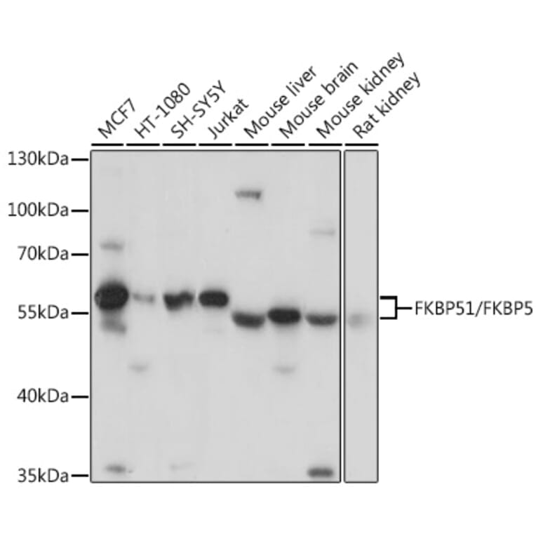 Western Blot - Anti-FKBP51 Antibody (A9309) - Antibodies.com