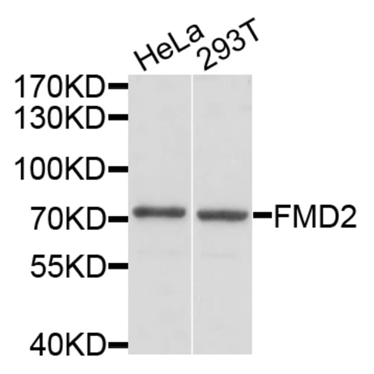 Western Blot - Anti-FMO2 Antibody (A3864) - Antibodies.com