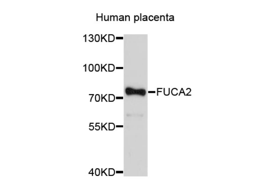 Western Blot - Anti-FUCA2 Antibody (A3867) - Antibodies.com