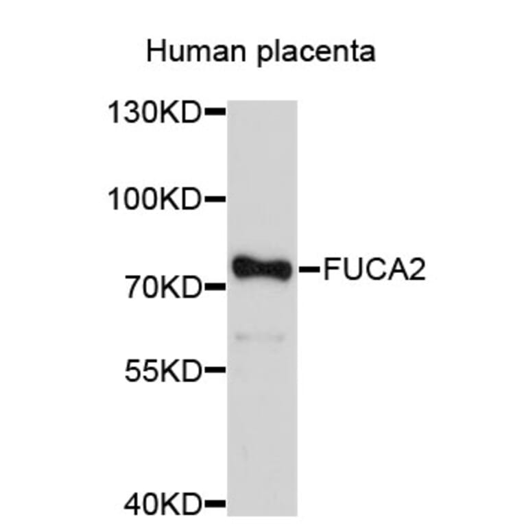 Western Blot - Anti-FUCA2 Antibody (A3867) - Antibodies.com