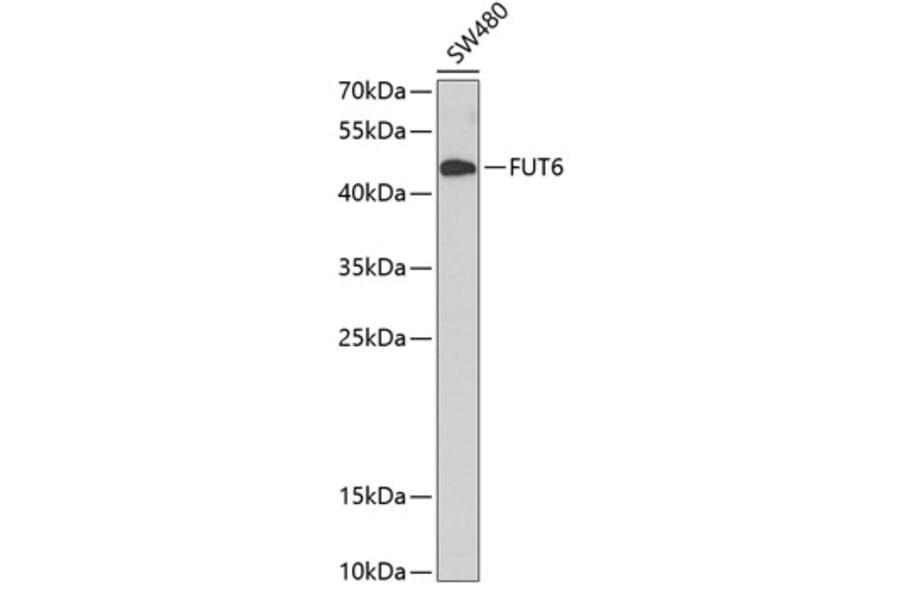 Western Blot - Anti-FUT6 Antibody (A9312) - Antibodies.com