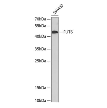 Western Blot - Anti-FUT6 Antibody (A9312) - Antibodies.com