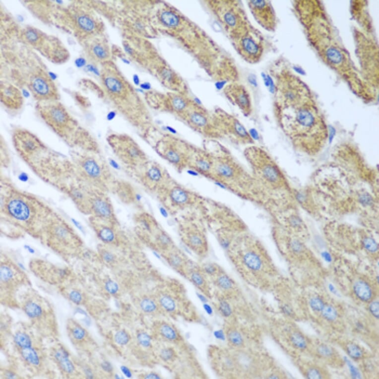 Immunohistochemistry - Anti-FUT6 Antibody (A9312) - Antibodies.com