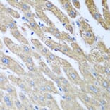 Immunohistochemistry - Anti-FUT6 Antibody (A9312) - Antibodies.com