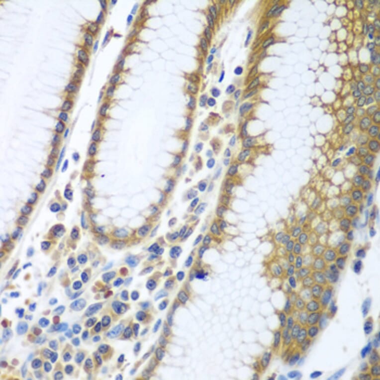 Immunohistochemistry - Anti-FUT6 Antibody (A9312) - Antibodies.com