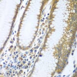 Immunohistochemistry - Anti-FUT6 Antibody (A9312) - Antibodies.com