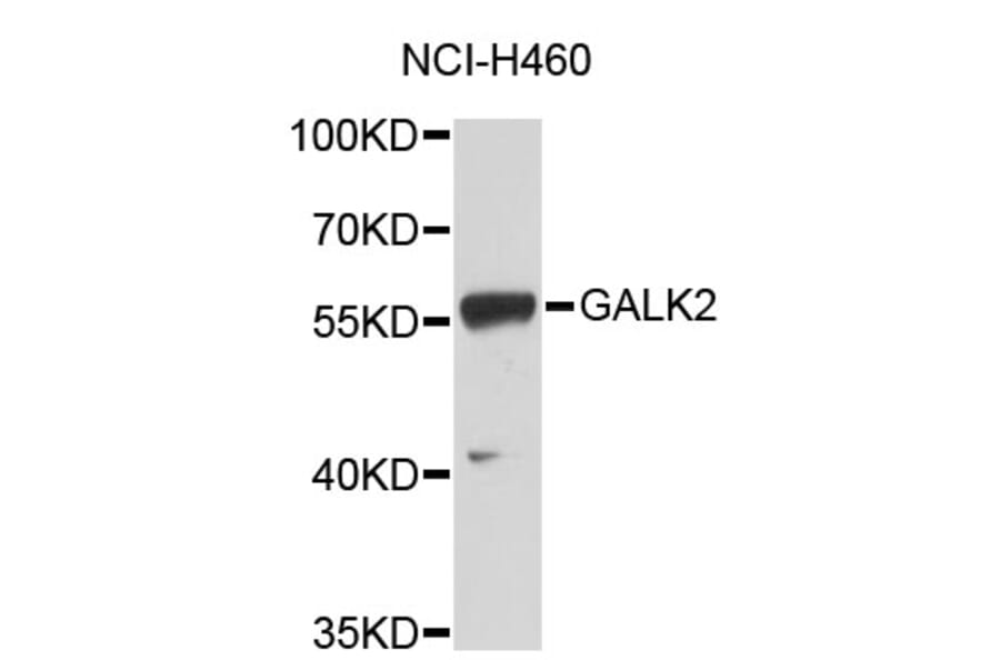 Western Blot - Anti-GALK2 Antibody (A3875) - Antibodies.com