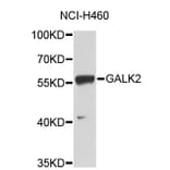 Western Blot - Anti-GALK2 Antibody (A3875) - Antibodies.com