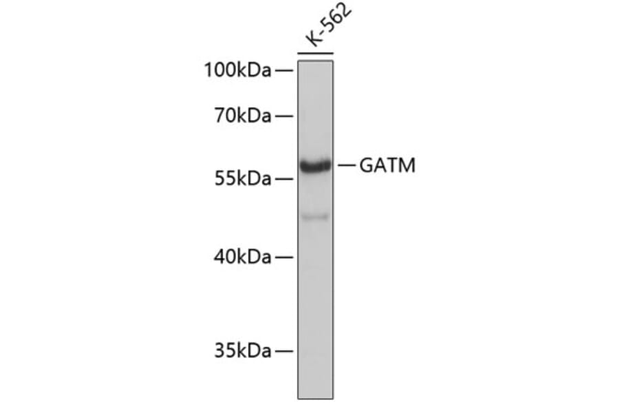 Western Blot - Anti-GATM Antibody (A3878) - Antibodies.com