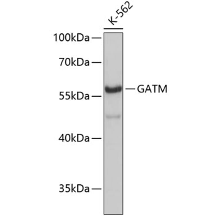 Western Blot - Anti-GATM Antibody (A3878) - Antibodies.com