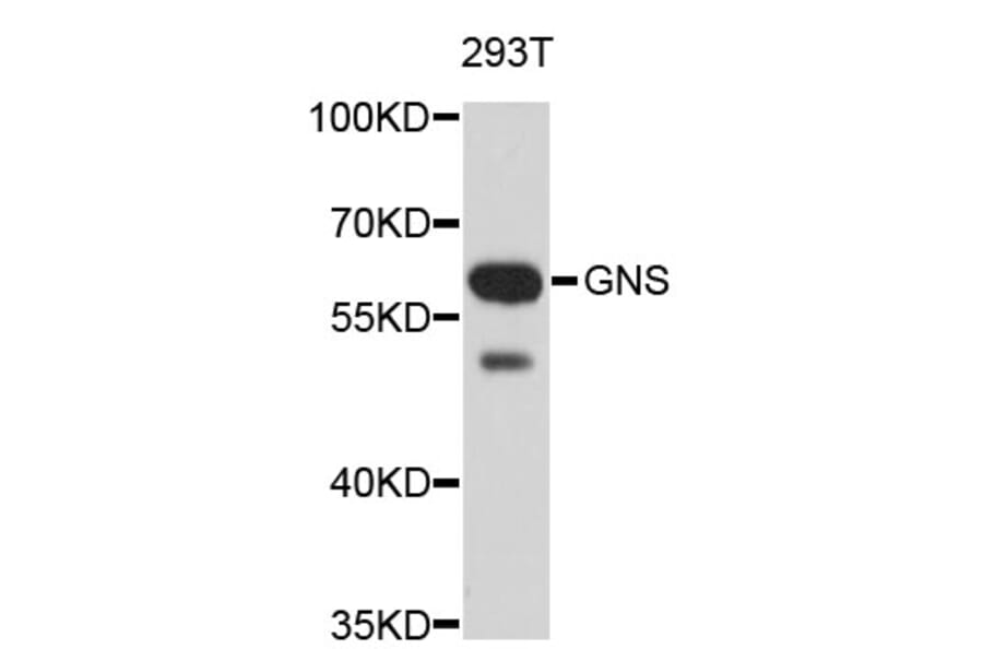 Western Blot - Anti-GNS Antibody (A3891) - Antibodies.com