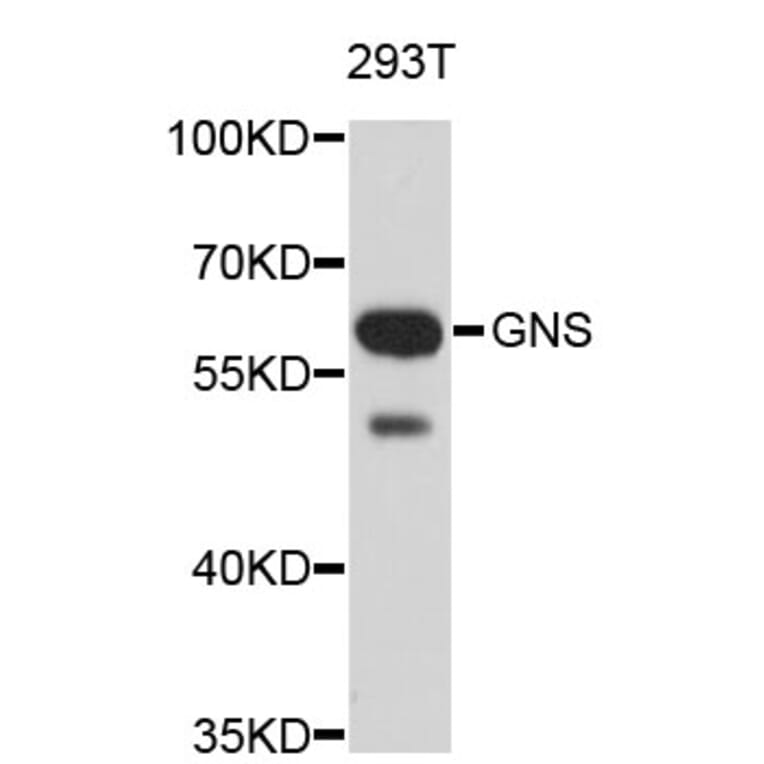 Western Blot - Anti-GNS Antibody (A3891) - Antibodies.com