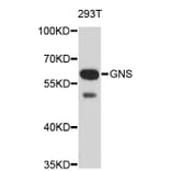 Western Blot - Anti-GNS Antibody (A3891) - Antibodies.com