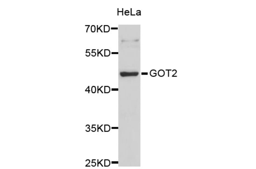 Western Blot - Anti-GOT2 Antibody (A3893) - Antibodies.com