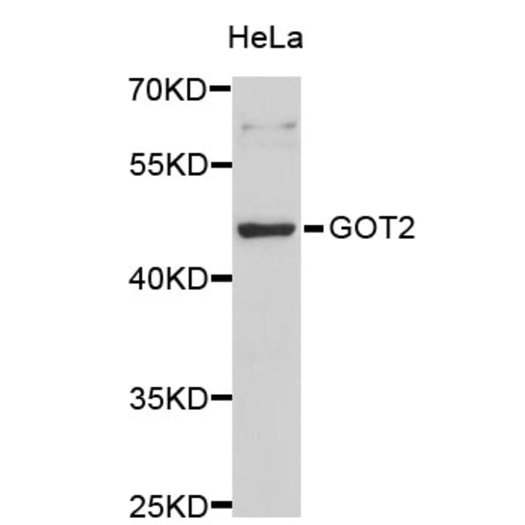 Western Blot - Anti-GOT2 Antibody (A3893) - Antibodies.com