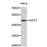 Western Blot - Anti-GOT2 Antibody (A3893) - Antibodies.com