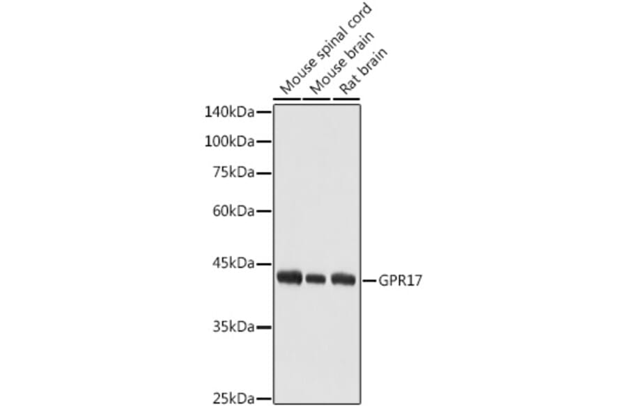 Western Blot - Anti-GPCR GPR17 Antibody (A9318) - Antibodies.com