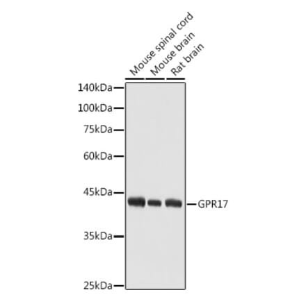 Western Blot - Anti-GPCR GPR17 Antibody (A9318) - Antibodies.com