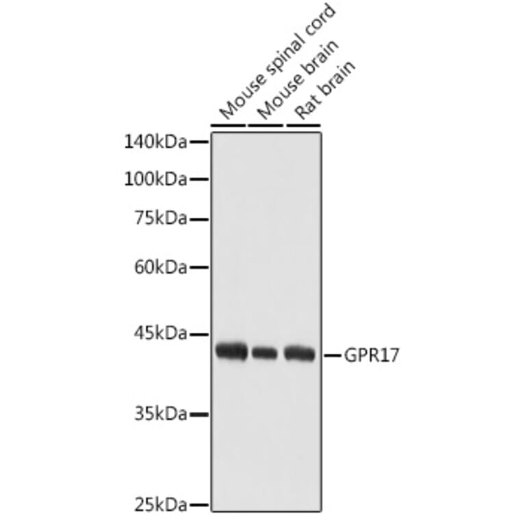 Western Blot - Anti-GPCR GPR17 Antibody (A9318) - Antibodies.com