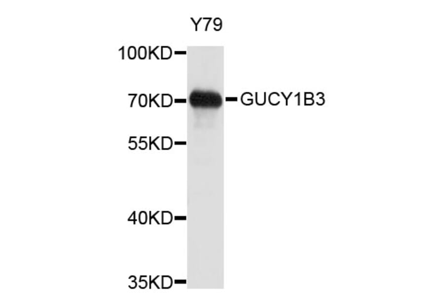 Western Blot - Anti-GUCY1B3 Antibody (A3906) - Antibodies.com