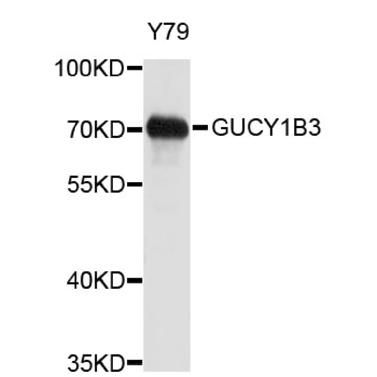 Western Blot - Anti-GUCY1B3 Antibody (A3906) - Antibodies.com