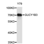 Western Blot - Anti-GUCY1B3 Antibody (A3906) - Antibodies.com