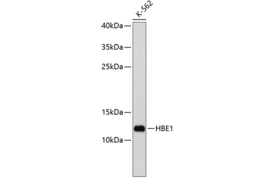 Western Blot - Anti-HBE Antibody (A9321) - Antibodies.com