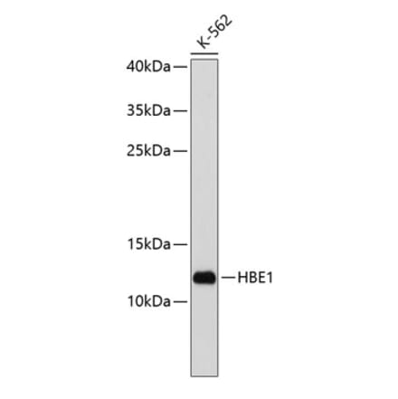Western Blot - Anti-HBE Antibody (A9321) - Antibodies.com