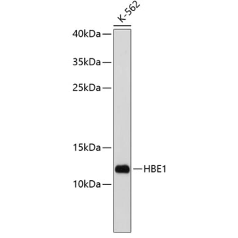 Western Blot - Anti-HBE Antibody (A9321) - Antibodies.com
