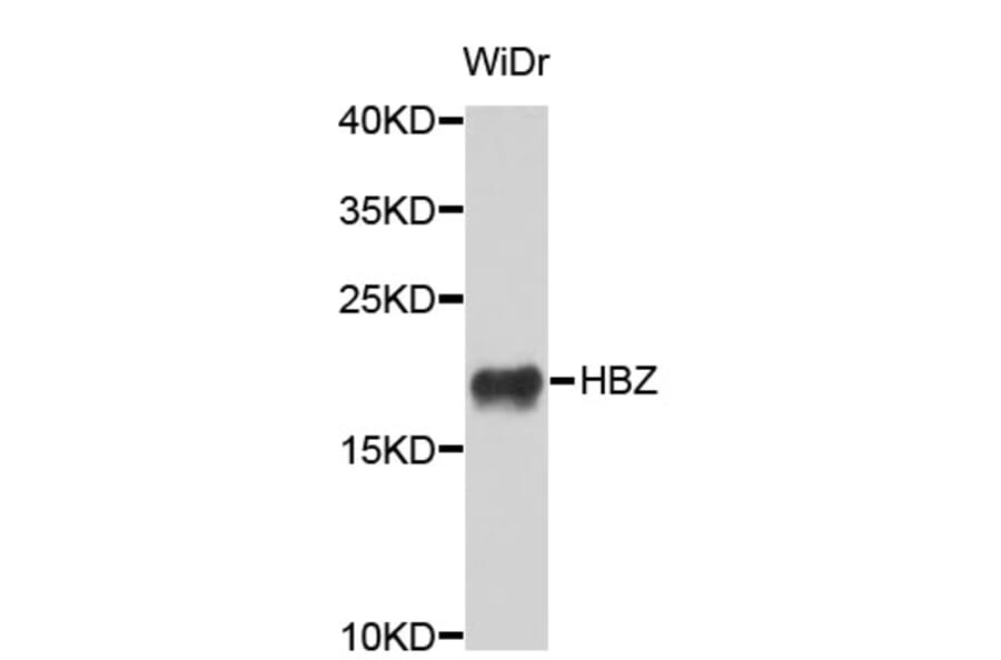 Western Blot - Anti-HBZ Antibody (A3910) - Antibodies.com