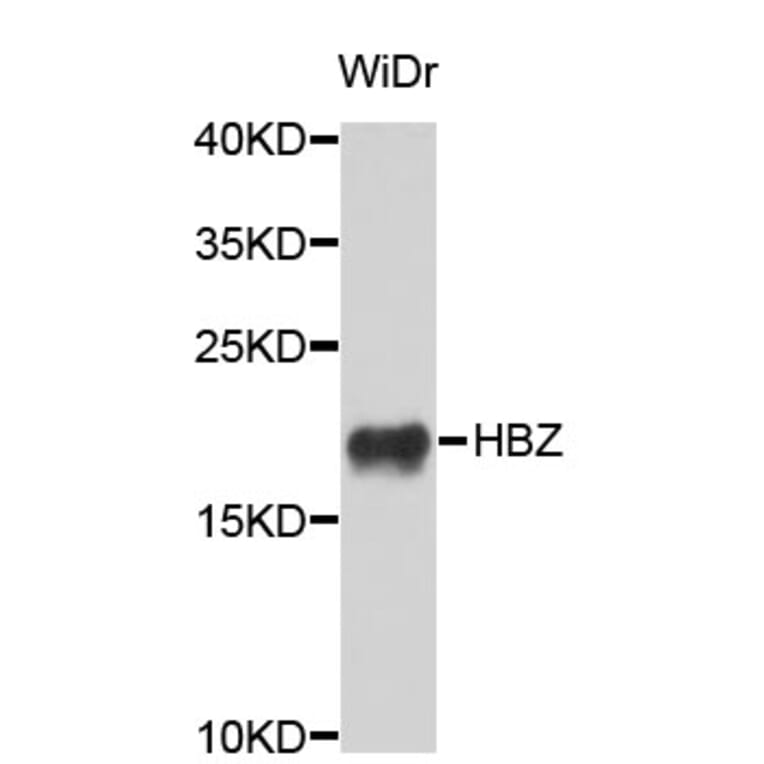 Western Blot - Anti-HBZ Antibody (A3910) - Antibodies.com