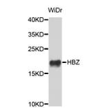 Western Blot - Anti-HBZ Antibody (A3910) - Antibodies.com