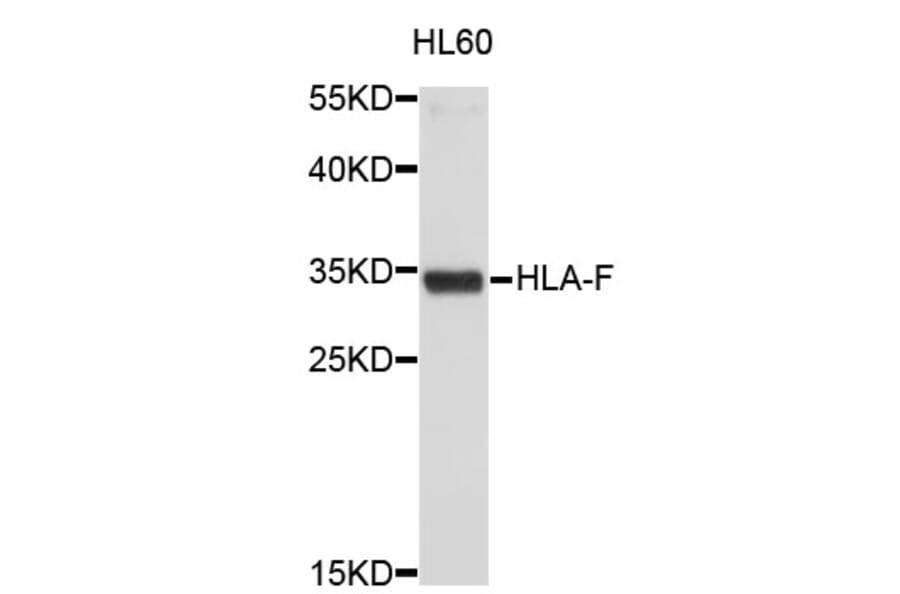 Western Blot - Anti-HLA-F Antibody (A3913) - Antibodies.com