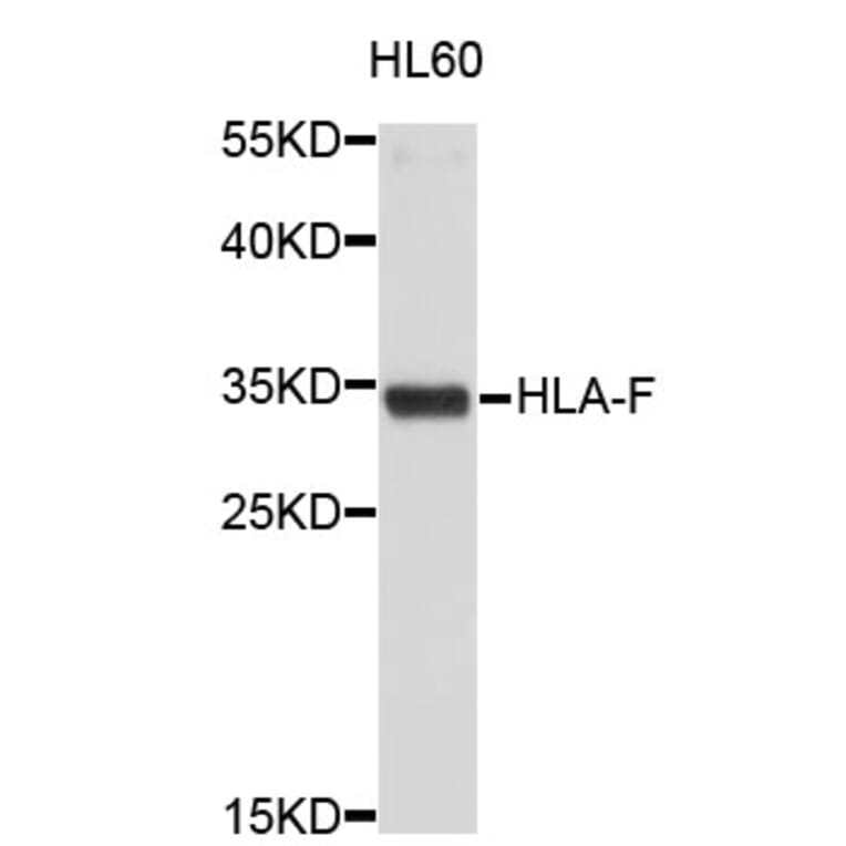 Western Blot - Anti-HLA-F Antibody (A3913) - Antibodies.com