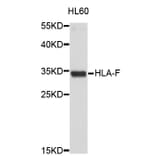 Western Blot - Anti-HLA-F Antibody (A3913) - Antibodies.com