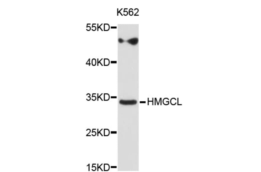 Western Blot - Anti-HMGCL Antibody (A3915) - Antibodies.com