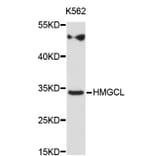 Western Blot - Anti-HMGCL Antibody (A3915) - Antibodies.com