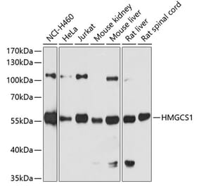 Western Blot - Anti-HMGCS1 Antibody (A9326) - Antibodies.com