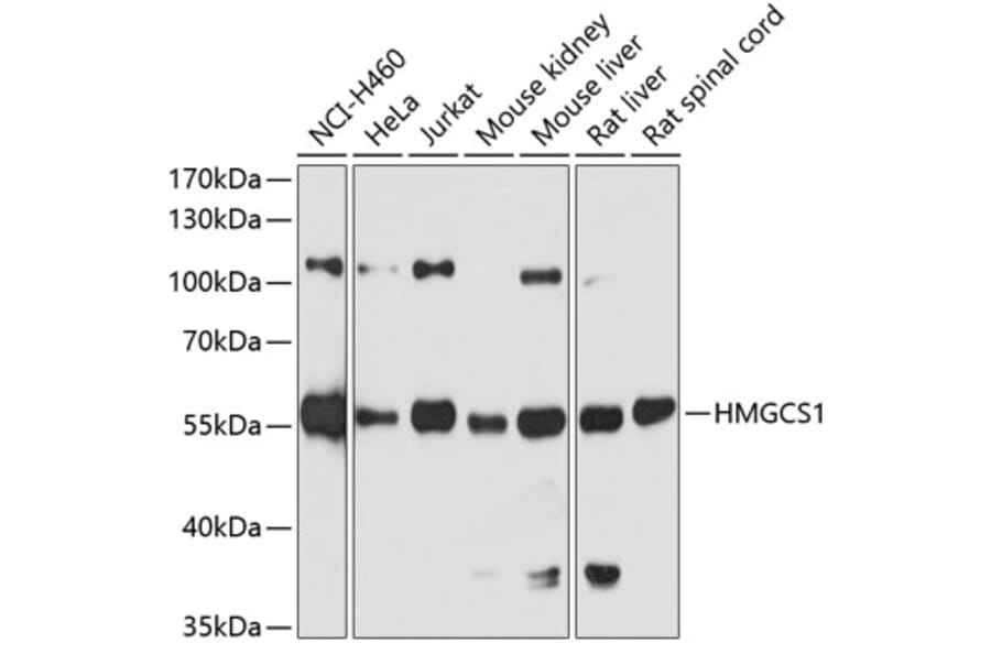Western Blot - Anti-HMGCS1 Antibody (A9326) - Antibodies.com