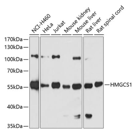 Western Blot - Anti-HMGCS1 Antibody (A9326) - Antibodies.com